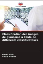 Classification des images de glaucome à l'aide de différents classificateurs