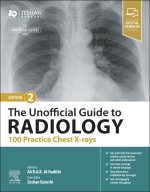 The Unofficial Guide to Radiology: 100 Practice Chest X Rays