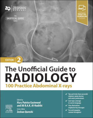 The Unofficial Guide to Radiology: 100 Practice Abdominal X Rays