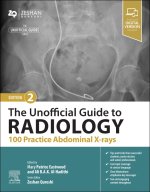 The Unofficial Guide to Radiology: 100 Practice Abdominal X Rays