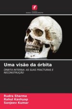 Uma vis?o da órbita