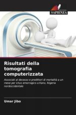 Risultati della tomografia computerizzata
