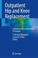 Outpatient Hip and Knee Replacement