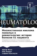 Mnozhestwennaq mieloma pozhilyh w rewmatologii: istoriq bolezni 51 pacienta