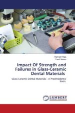 Impact Of Strength and Failures in Glass-Ceramic Dental Materials