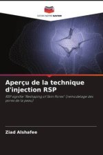 Aperçu de la technique d'injection RSP