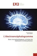 L?électroencéphalogramme