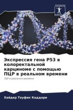 Jexpressiq gena P53 w kolorektal'noj karcinome s pomosch'ü PCR w real'nom wremeni