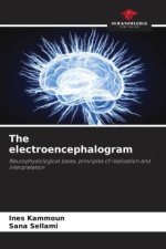 The electroencephalogram
