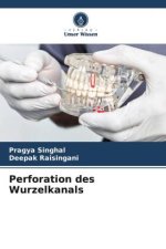 Perforation des Wurzelkanals
