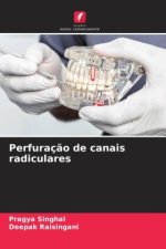 Perfuraç?o de canais radiculares