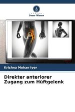 Direkter anteriorer Zugang zum Hüftgelenk
