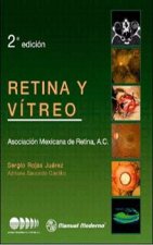 RETINA Y VITREO.