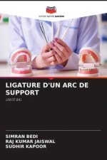 LIGATURE D'UN ARC DE SUPPORT