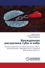 Vrozhdennaq rasschelina guby i neba