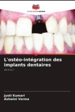 L'ostéo-intégration des implants dentaires