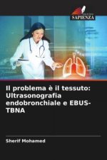 Il problema ? il tessuto: Ultrasonografia endobronchiale e EBUS-TBNA