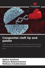 Congenital cleft lip and palate