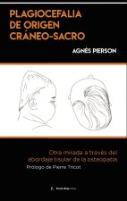 Plagiocefalia de origen cráneo-sacro