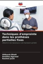 Techniques d'empreinte dans les prothèses partielles fixes