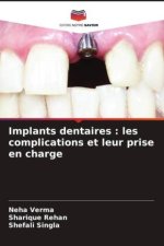 Implants dentaires : les complications et leur prise en charge