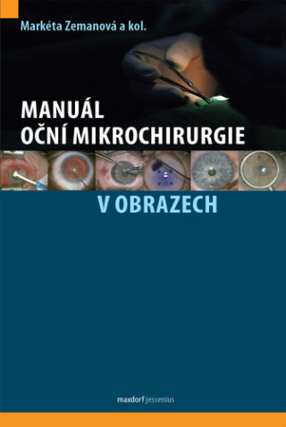 Manuál oční mikrochirurgie v obrazech