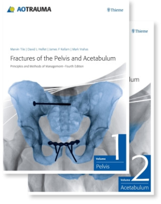 Fractures of the Pelvis and Acetabulum (AO)