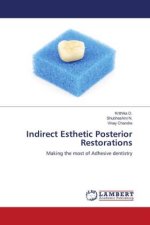 Indirect Esthetic Posterior Restorations