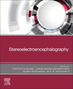 Stereoelectroencephalography