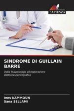 SINDROME DI GUILLAIN BARRE