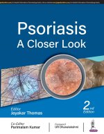 Psoriasis