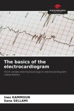 The basics of the electrocardiogram