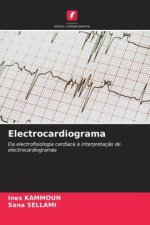 Electrocardiograma
