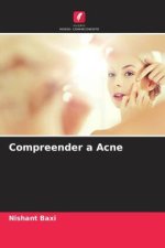 Compreender a Acne