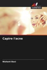 Capire l'acne