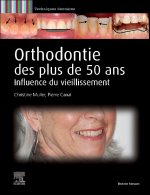 Orthodontie des plus de 50 ans