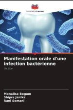 Manifestation orale d'une infection bactérienne