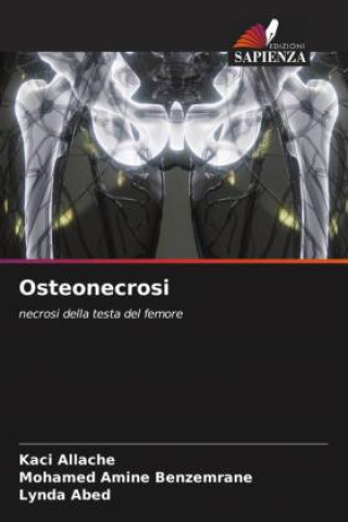 Osteonecrosi