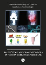 DIAGNOSTICO MICROBIOLOGICO INFECCION PROTESIS ARTICULAR