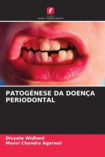 PATOGÉNESE DA DOENÇA PERIODONTAL