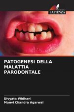 PATOGENESI DELLA MALATTIA PARODONTALE