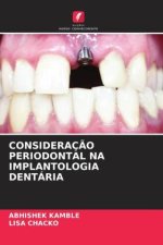 CONSIDERAÇ?O PERIODONTAL NA IMPLANTOLOGIA DENTÁRIA