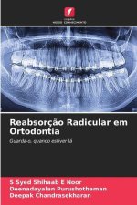 Reabsorç?o Radicular em Ortodontia
