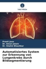 Automatisiertes System zur Erkennung von Lungenkrebs durch Bildsegmentierung