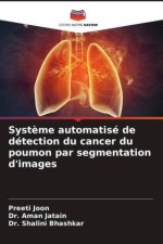 Syst?me automatisé de détection du cancer du poumon par segmentation d'images