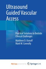 Ultrasound Guided Vascular Access
