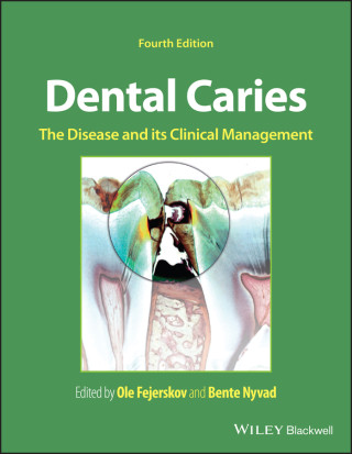 Dental Caries: The Disease and its Clinical Manage ment 4th Edition