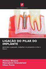 LIGAÇ?O DO PILAR DO IMPLANTE