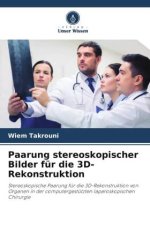 Paarung stereoskopischer Bilder für die 3D-Rekonstruktion