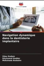 Navigation dynamique dans la dentisterie implantaire